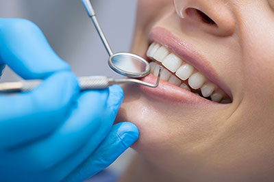 Granger Dentistry | ClearCorrect reg , Dental Sealants and Veneers