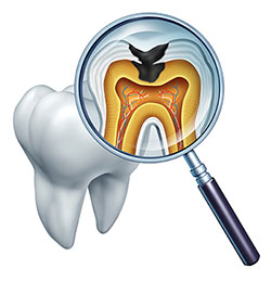 Granger Dentistry | CEREC, Extractions and E4D