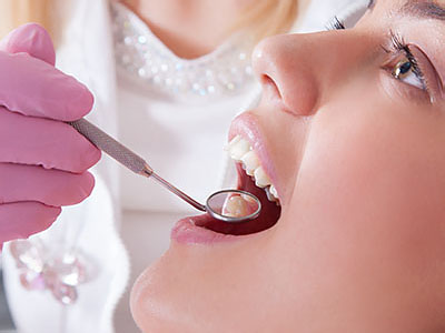 Granger Dentistry | Dental Sealants, Inlays  amp  Onlays and Orthodontics